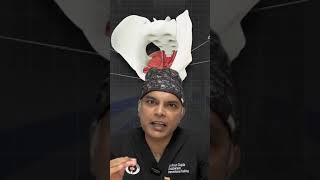 What Is the Pelvic Floor and Why Is It Important testicularpain pelvicpain ytshorts doctor [upl. by Taft]