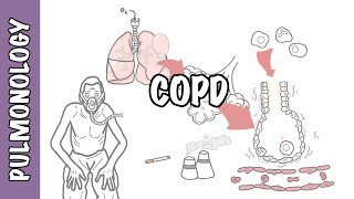 Understanding COPD  Chronic obstructive pulmonary disease cause pathophysiology and treatment [upl. by Blanche]