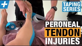 How to Tape for Peroneal Tendon Injuries [upl. by Inaboy]