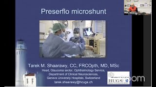 Glaucoma  Taming The MonsterPreserflo micros hunt  Prof Tarek Sharawy [upl. by Cia]