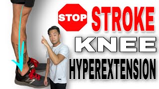 How to Fix Knee Hyperextension after a Stroke [upl. by Ttelracs465]