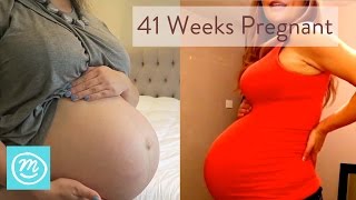 41 Weeks Pregnant What You Need To Know  Channel Mum [upl. by Neeluqcaj]