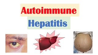 Autoimmune Hepatitis  Pathogenesis Signs amp Symptoms Diagnosis Treatment [upl. by Nissensohn]