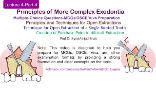 Lecture 4 Part4 MCQs  Open Extraction of Single Rooted Tooth  OSCE  VIVA [upl. by Edia]