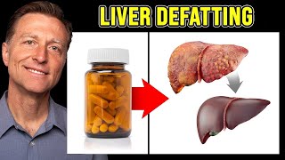 The BEST Vitamin to Cleanse a Fatty Liver  Dr Berg [upl. by Irek]