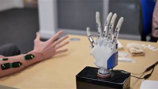 Improving the control of prosthetic hands [upl. by Nylkaj]