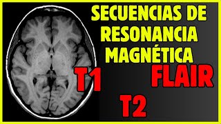 🤯Secuencias de RESONANCIA MAGNÉTICA  ¿Cómo diferenciarlas [upl. by Alleinad]