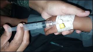 injection injection video new injection doctor  big injection baby video [upl. by Dyob581]