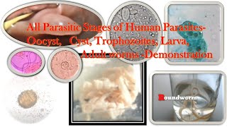 Human Parasites egg larva cyst oocyst trophozoite and adult worms Demonstration [upl. by Strickland]