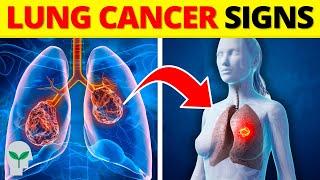 You MUST KNOW the Early Warning Signs of Lung Cancer [upl. by Leirej]