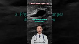 Breast Duct Dilatation Differential Diagnoses radiology [upl. by Lazar]