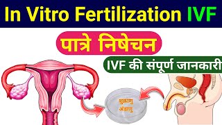 IVF  ivf procedure step by step  ivf process class 12 up board  In Vitro Fertilization  biology [upl. by Etteyniv]