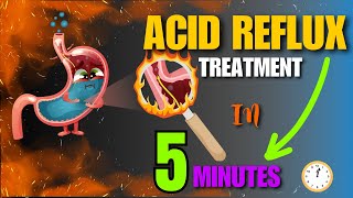 Effective Home Remedies For Acid Reflux  Natural Treatment At Home [upl. by Orthman873]