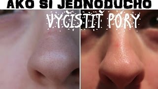 Jednoduchý návod ako si vyčistiť póry  DIY pore strip [upl. by Berky]