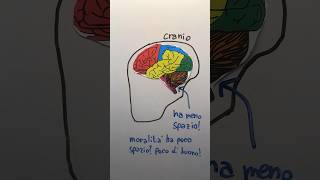 Le ASSURDE TEORIE di CESARE LOMBROSO 🧠 lombroso criminale teoria frenologia imparaconyoutube [upl. by Olympium]