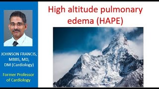 High altitude pulmonary edema HAPE [upl. by Arotak]