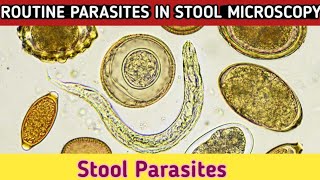 Routine Parasites in stool microscopy Stool Parasites under microscope [upl. by Koenig380]