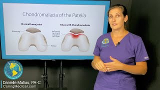 Can chondromalacia patella be treated with Prolotherapy FAQ about knee degeneration and arthritis [upl. by Nirat476]