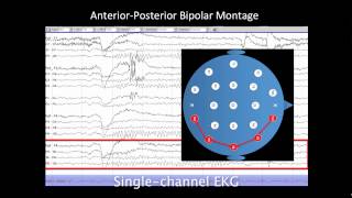 Introduction to EEG [upl. by Onitnatsnoc543]