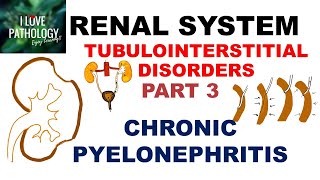 CHRONIC PYELONEPHRITIS  PATHOLOGY [upl. by Olivia]