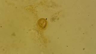 Fertilised decorticated egg of Ascaris lumbricoides [upl. by Enelyaj443]