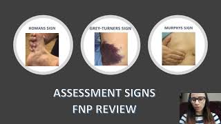 NP Board Review McBurney Cullens Psoas Lachman Homans Obturators McMurray Tinels sign [upl. by Ttezil]