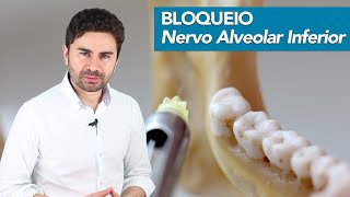 PassoaPasso do Bloqueio do Nervo Alveolar Inferior  Prof Fernando Giovanella [upl. by Tod543]