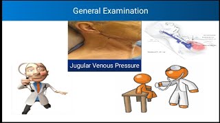 General Examination  Jugular Venous Pressure  JVP  Components of JVP  Cuases of Raised JVP [upl. by Tallbot521]