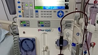 Dialysis closing full video on fresenius 4008 S  how to close dialysis fresenius mechine [upl. by Redwine]