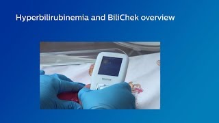 Hyperbilirubinemia  Jaundice  Biochemistry [upl. by Rocker]