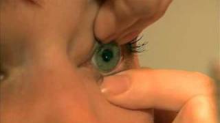 SOClear Contact Lens Removal [upl. by Sverre]