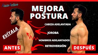 🔴 Programa de Ejercicios para MEJORAR la Postura de la ESPALDA JOROBADA ¡PONTE DERECHO SORPRESA 😮🎁 [upl. by Azer508]