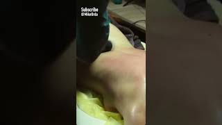 Back massage amp cupping therapy  МАССАЖ СПИНЫ  Russia [upl. by Gomez]