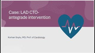 My first experience with a new CTO wire Shun GN2 wire LAD CTO Case [upl. by Lois]