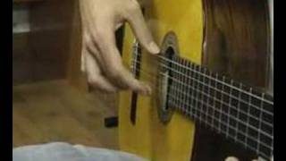 1Flamenco guitarist and focal hand dystonia Distonía focal [upl. by Aehcsrop]