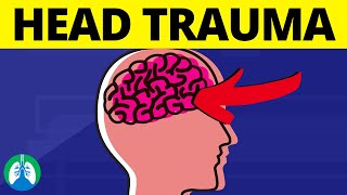 Head Trauma 🧠 Quick Medical Overview  Traumatic Brain Injury [upl. by Mcleroy945]