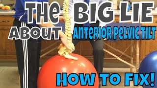 The BIG LIE About Anterior Pelvic Tilt How to Fix [upl. by Omor19]