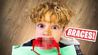 9 YEAR OLD GETTING BRACES ROWDYROGAN [upl. by Airlie]