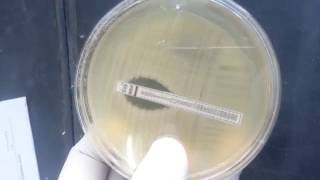 Minimum Inhibitory Concentration MIC Test [upl. by Ayimat]