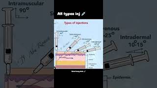 All type injection iv im sc [upl. by Niawd43]