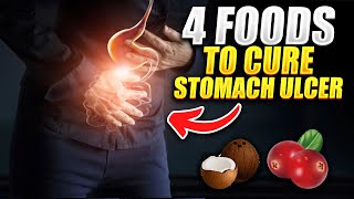 4 FOODS TO CURE STOMACH ULCER [upl. by Pillihpnhoj538]