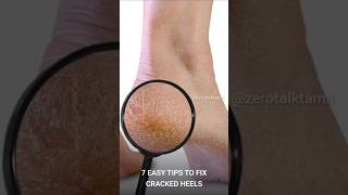 Easy Tips To Fix Cracked Heels footcare crackedheels crackedheelsremedy [upl. by Aratal558]