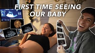 OUR FIRST TRIMESTER ULTRASOUNDS [upl. by Elana]