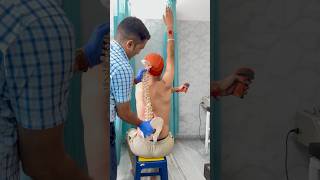 Severe idiopathic scoliosis treatment by DrRavi scoliosis chiropractor trend spine chiropractic [upl. by Harriett]