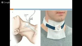 Emergency Cricothrotomy and Tracheostomy [upl. by Breana]