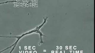 How Mercury Causes Brain Neuron Damage  Uni of Calgary [upl. by Llebiram]