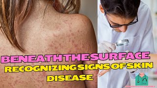 Beneath the Surface Recognizing Signs of Skin Diseases [upl. by Valsimot768]