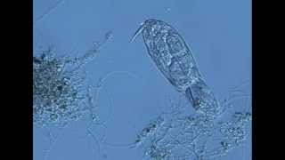 rotifer ingesting filamentous bacteria in activated sludgem1v [upl. by Ahsemak]