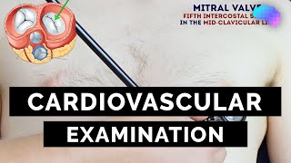 Cardiovascular Examination  OSCE Guide  UKMLA  CPSA [upl. by Niggem72]