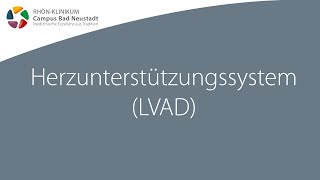 Herzunterstützungssystem LVAD  Infofilme zur HerzOP  RHÖNKLINIKUM Campus Bad Neustadt [upl. by Notlih766]